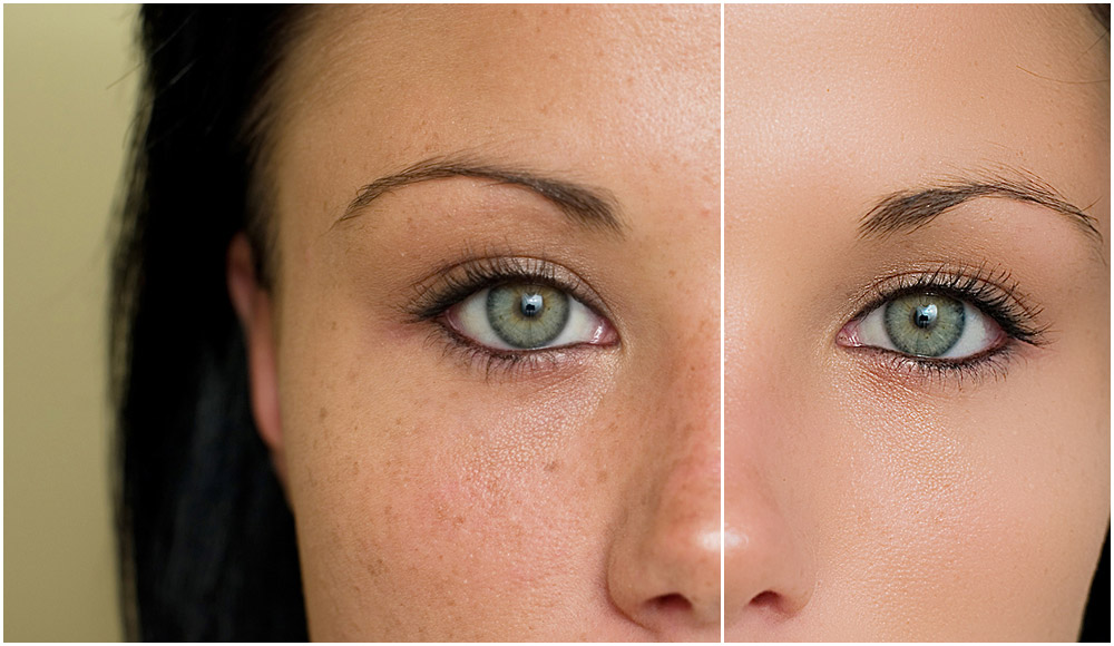 30 Manfaat Santan Kelapa untuk Kesehatan dan Kecantikan Yang Wajib Anda Ketahui 1